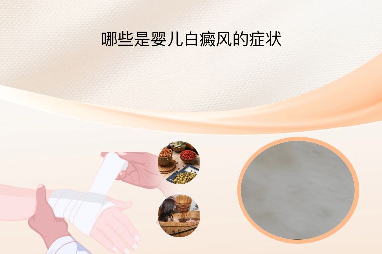 哪些是婴儿白癜风的症状