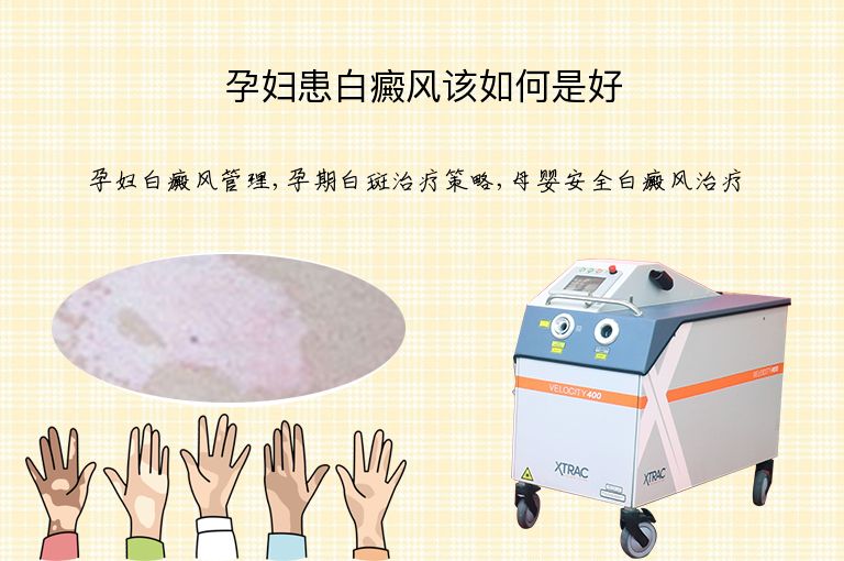 孕妇患白癜风该如何是好”