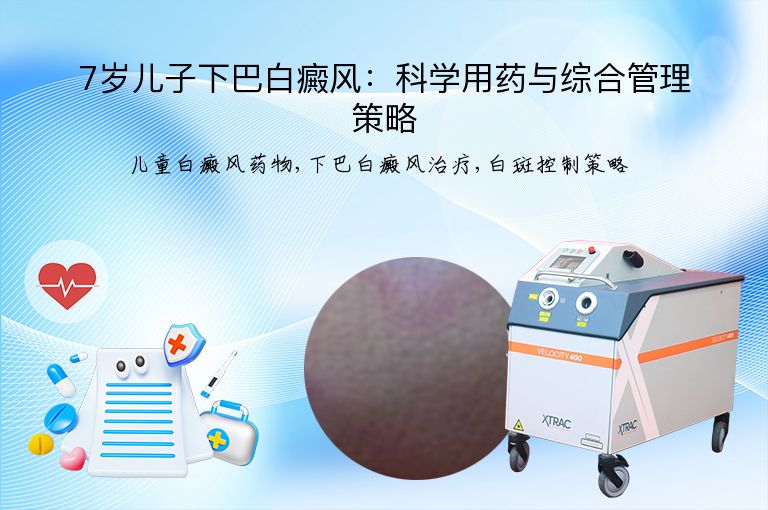 7岁儿子下巴白癜风：科学用药与综合管理策略”