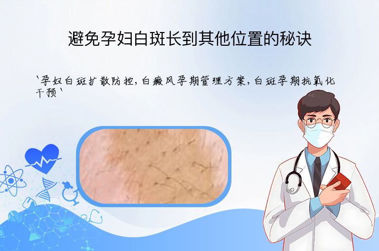 避免孕妇白斑长到其他位置的秘诀