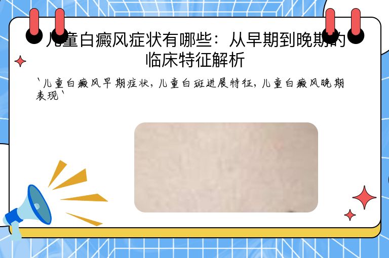 儿童白癜风症状有哪些:从早期到晚期的临床特征解析