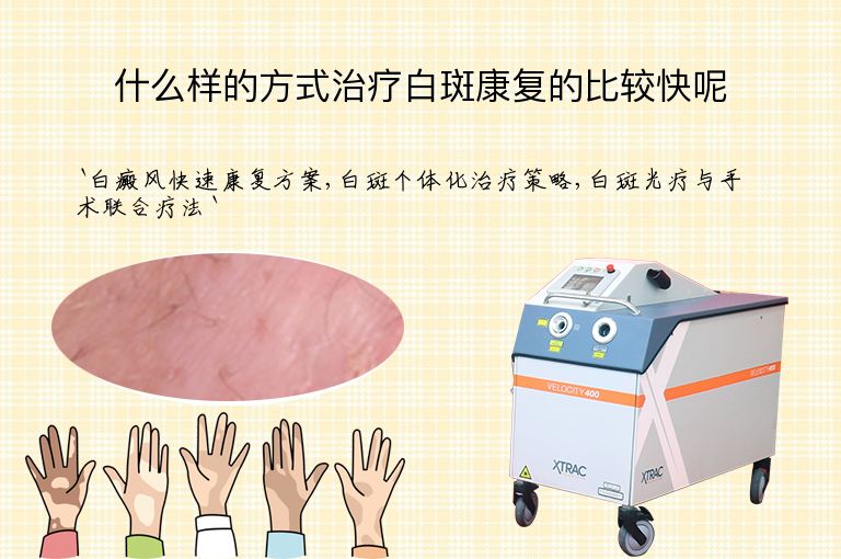 什么样的方式治疗白斑康复的比较快呢