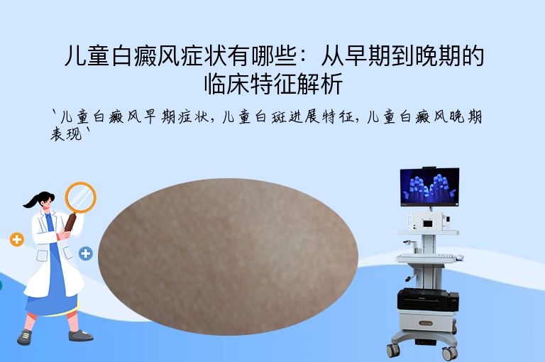 儿童白癜风症状有哪些:从早期到晚期的临床特征解析