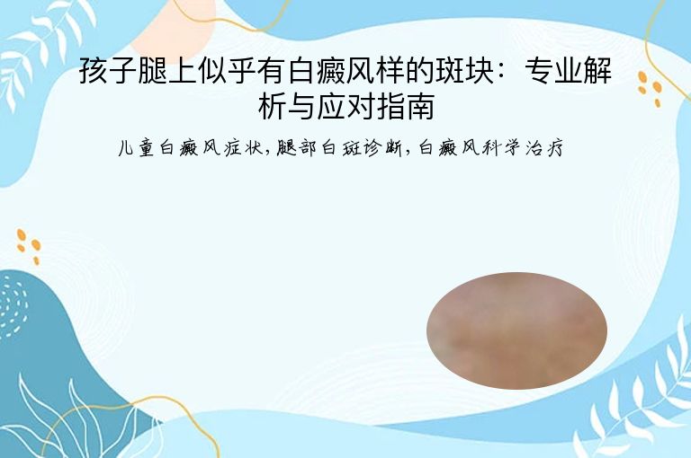 孩子腿上似乎有白癜风样的斑块:专业解析与应对指南”