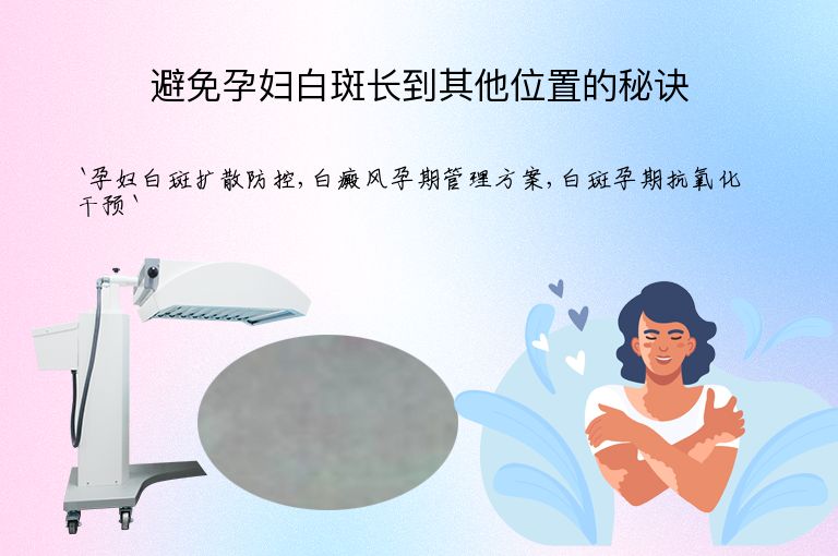 避免孕妇白斑长到其他位置的秘诀