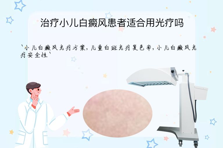 治疗小儿白癜风患者适合用光疗吗