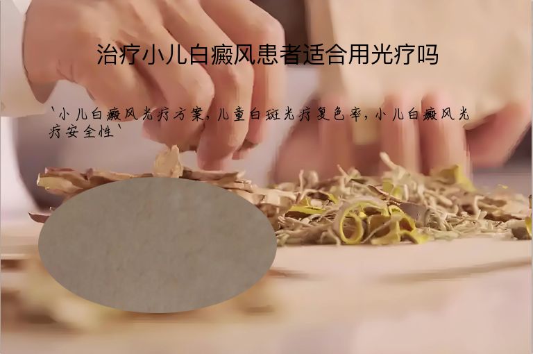 治疗小儿白癜风患者适合用光疗吗