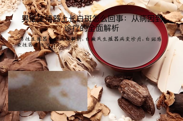 男性生殖器上长白斑怎么回事:从病因到诊疗的全面解析