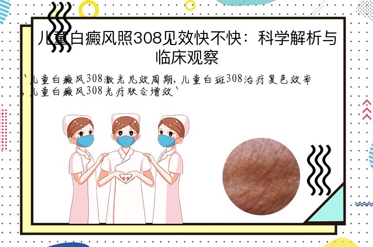儿童白癜风照308见效快不快：科学解析与临床观察