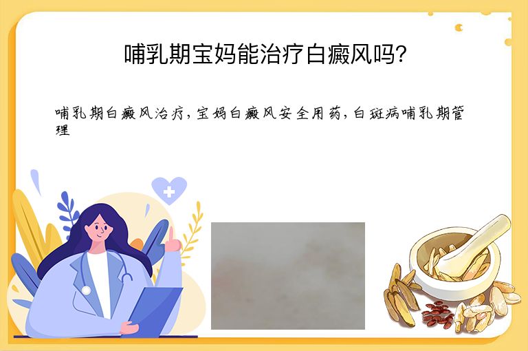 哺乳期宝妈能治疗白癜风吗?”
