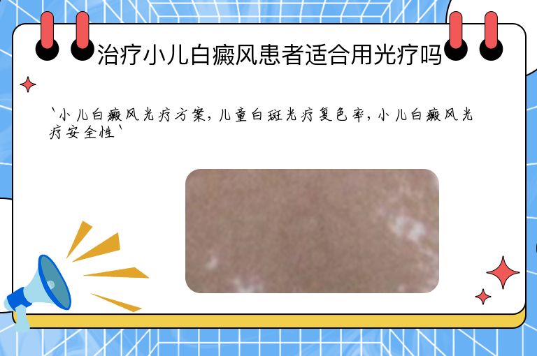 治疗小儿白癜风患者适合用光疗吗