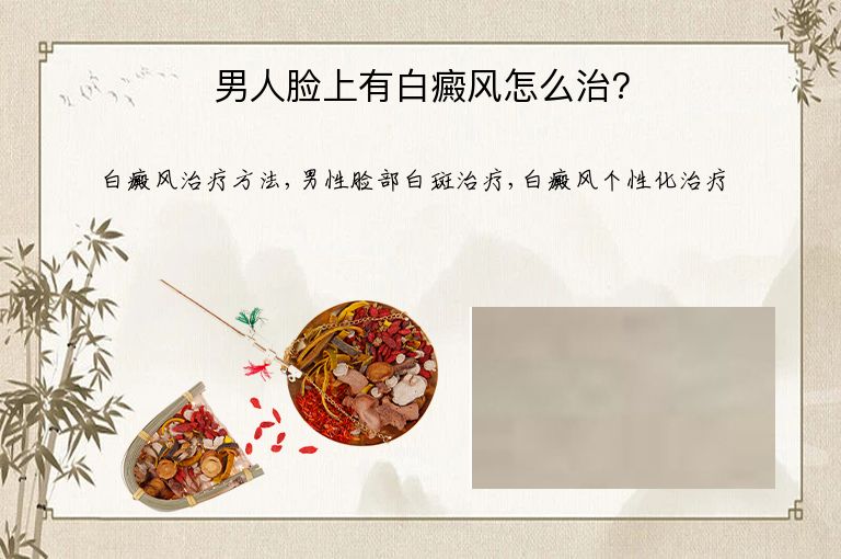男人脸上有白癜风怎么治?”