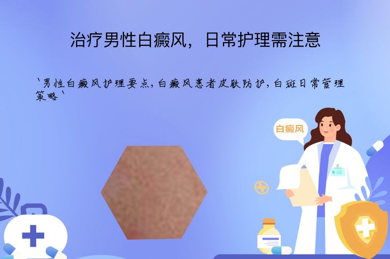 治疗男性白癜风,日常护理需注意