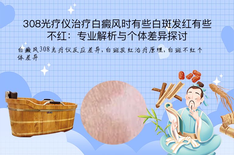 308光疗仪治疗白癜风时有些白斑发红有些不红:专业解析与个体差异探讨”