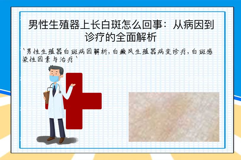 男性生殖器上长白斑怎么回事:从病因到诊疗的全面解析