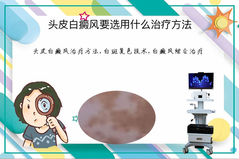 头皮白癜风要选用什么治疗方法”