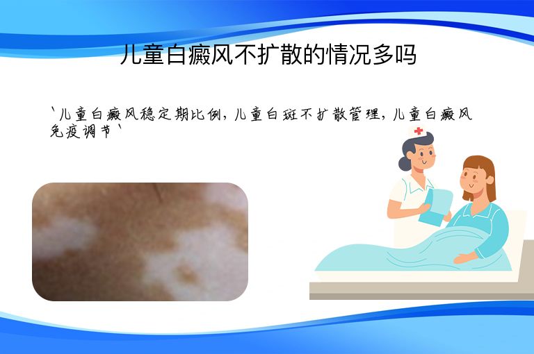 儿童白癜风不扩散的情况多吗”