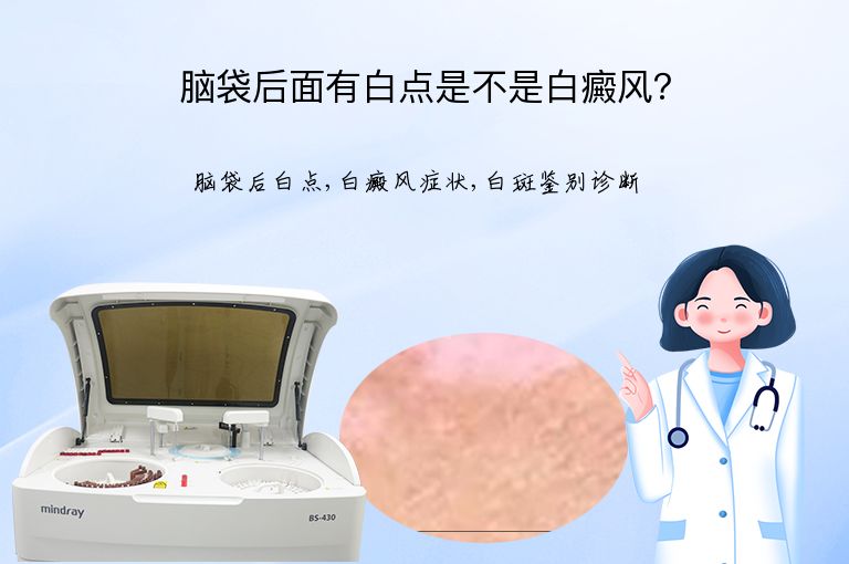 脑袋后面有白点是不是白癜风?”