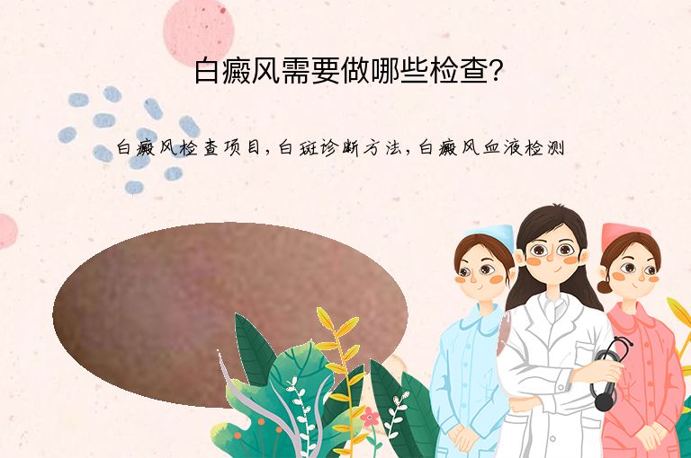 白癜风需要做哪些检查?”