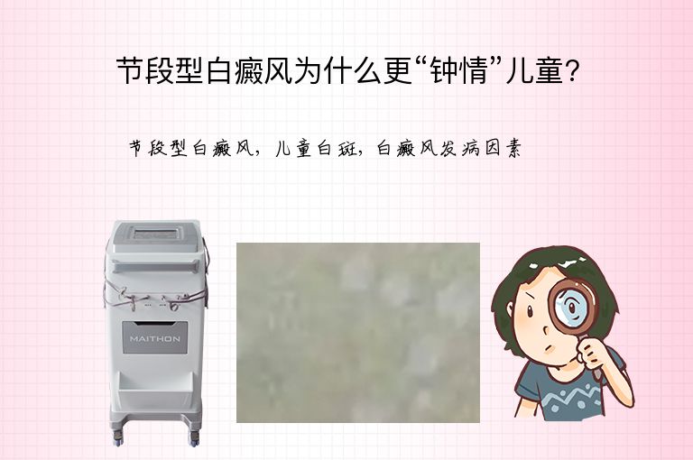 节段型白癜风为什么更“钟情”儿童?”