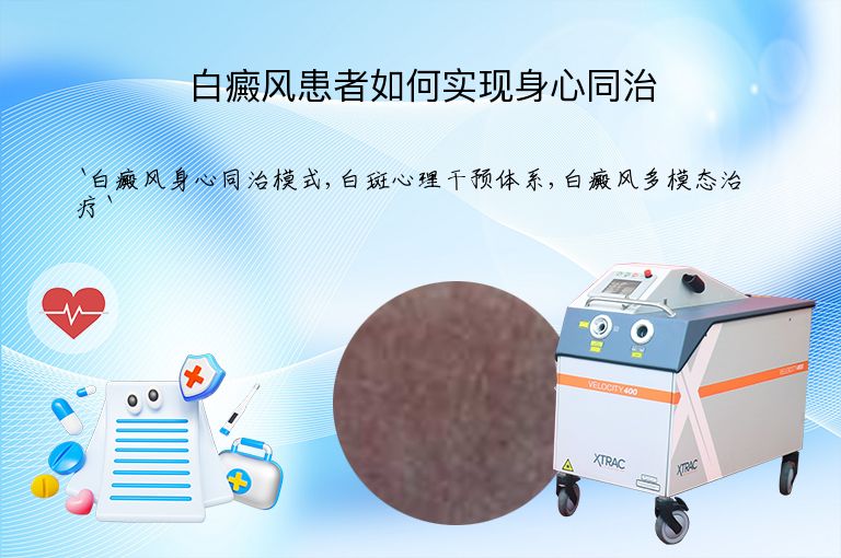 白癜风患者如何实现身心同治”