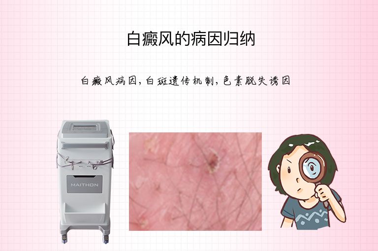 白癜风的病因归纳”