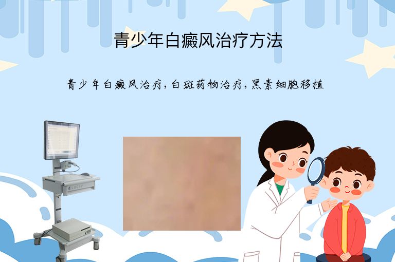 青少年白癜风治疗方法”
