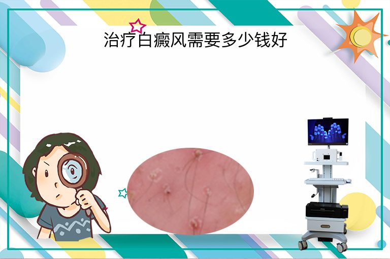 https://www.bdfsjzyy.com/d/file/p/173f2d2250292477ccca4d6cd2ef480b.jpeg