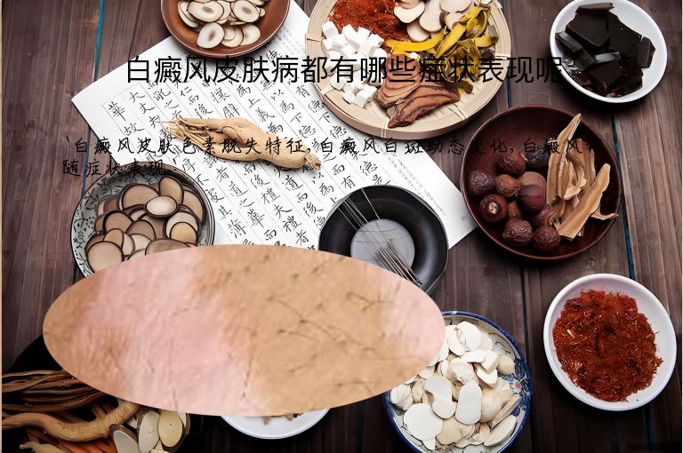 白癜风皮肤病都有哪些症状表现呢”
