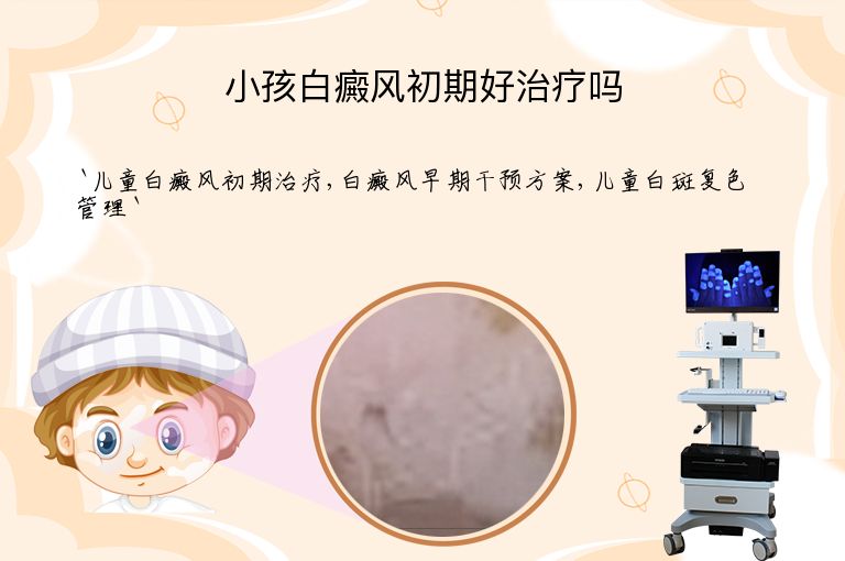 小孩白癜风初期好治疗吗