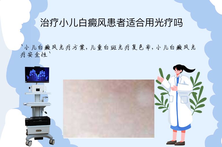 治疗小儿白癜风患者适合用光疗吗