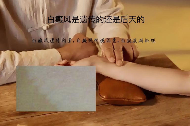 白癜风是遗传的还是后天的”