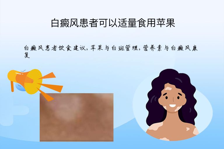白癜风患者可以适量食用苹果”
