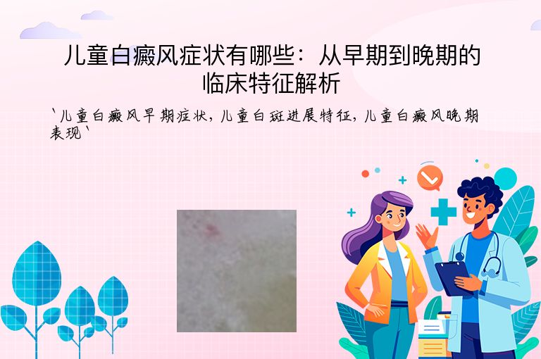 儿童白癜风症状有哪些：从早期到晚期的临床特征解析