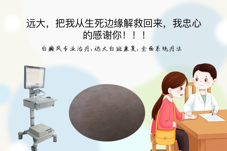 https://www.bdfsjzyy.com/d/file/p/a1bd364f615b13da31c1d3c649327c84.jpeg