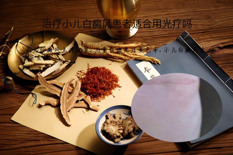 治疗小儿白癜风患者适合用光疗吗