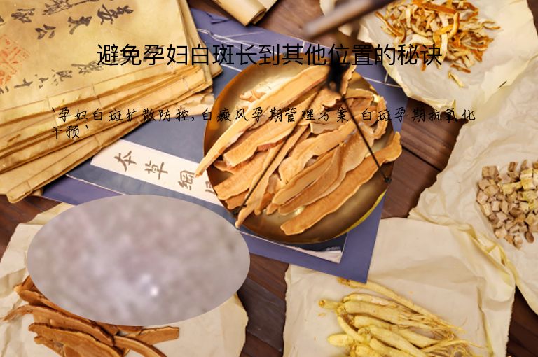 避免孕妇白斑长到其他位置的秘诀