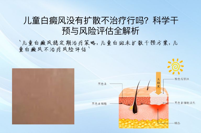 儿童白癜风没有扩散不治疗行吗？科学干预与风险评估全解析