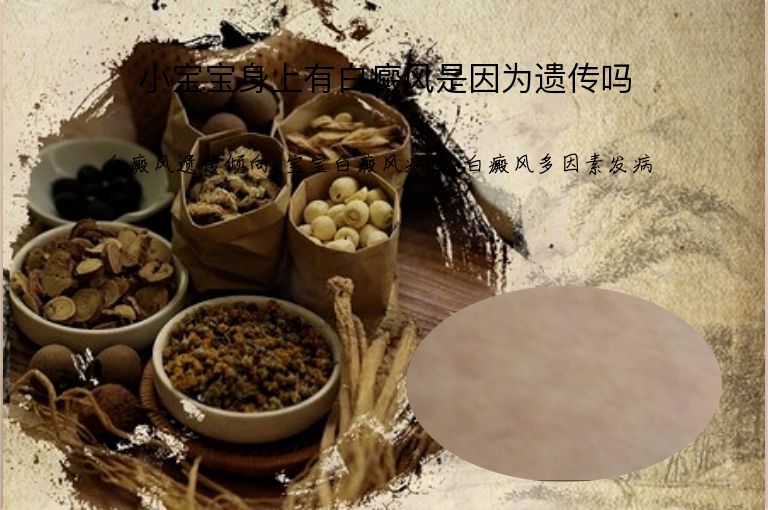 小宝宝身上有白癜风是因为遗传吗”