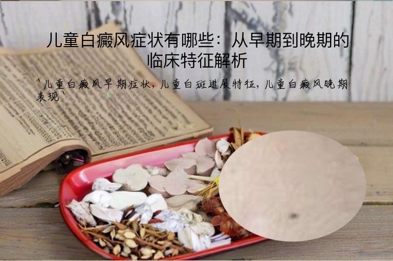 儿童白癜风症状有哪些:从早期到晚期的临床特征解析