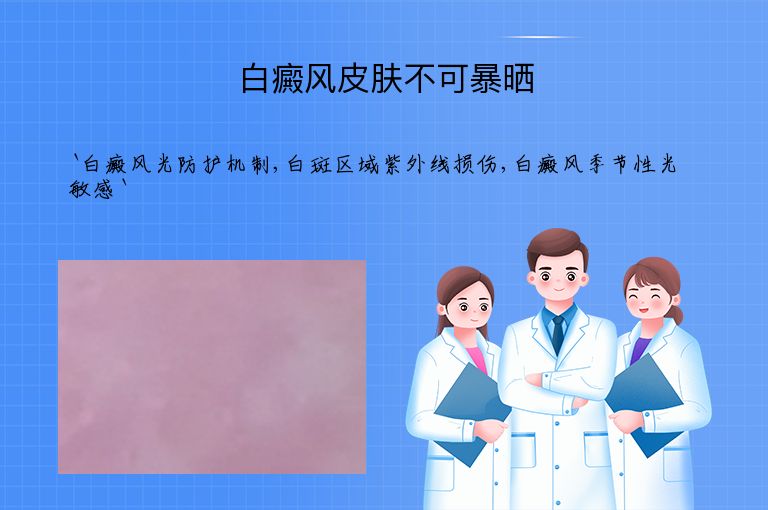 白癜风皮肤不可暴晒