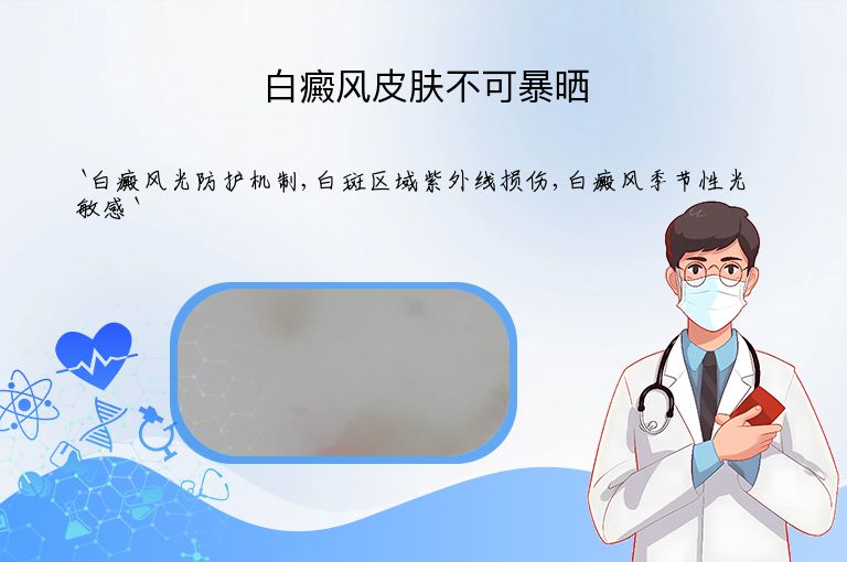 白癜风皮肤不可暴晒