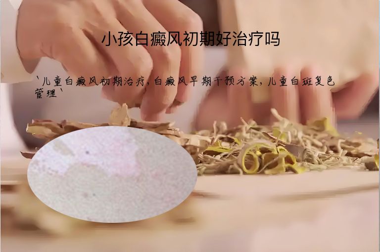 小孩白癜风初期好治疗吗