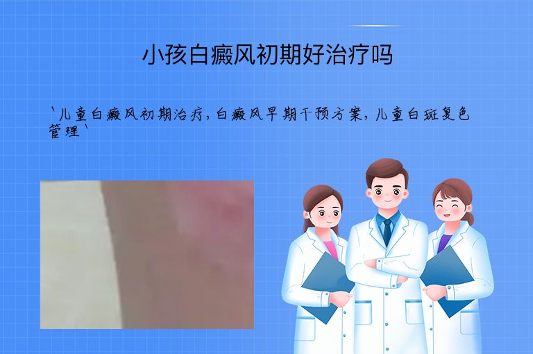 小孩白癜风初期好治疗吗