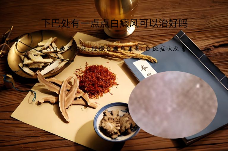https://www.bdfsjzyy.com/d/file/p/3243b883d02b2d38d35ef24066e6c249.jpeg