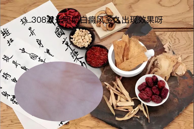308激光照射白癜风多久出现效果呀”