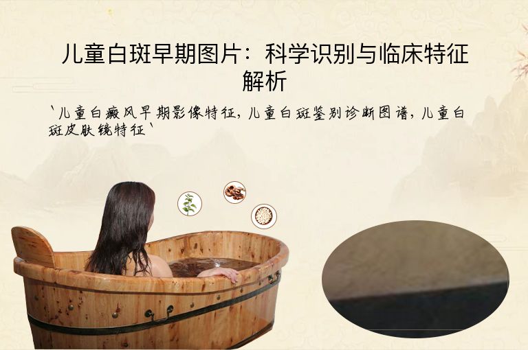 儿童白斑早期图片:科学识别与临床特征解析