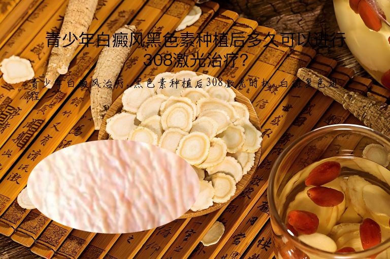 青少年白癜风黑色素种植后多久可以进行308激光治疗?”