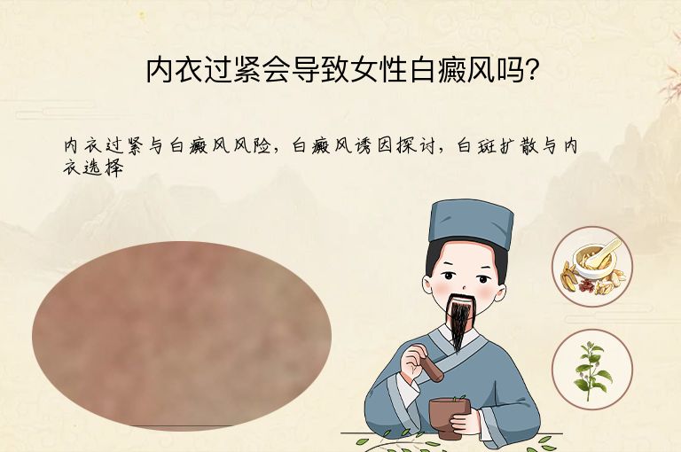 内衣过紧会导致女性白癜风吗？”