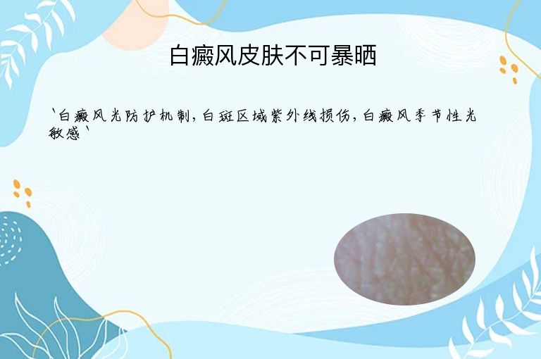 白癜风皮肤不可暴晒